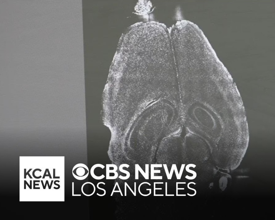 CBS News reports on advances in brain mapping research at UCLA B.R.A.I.N.